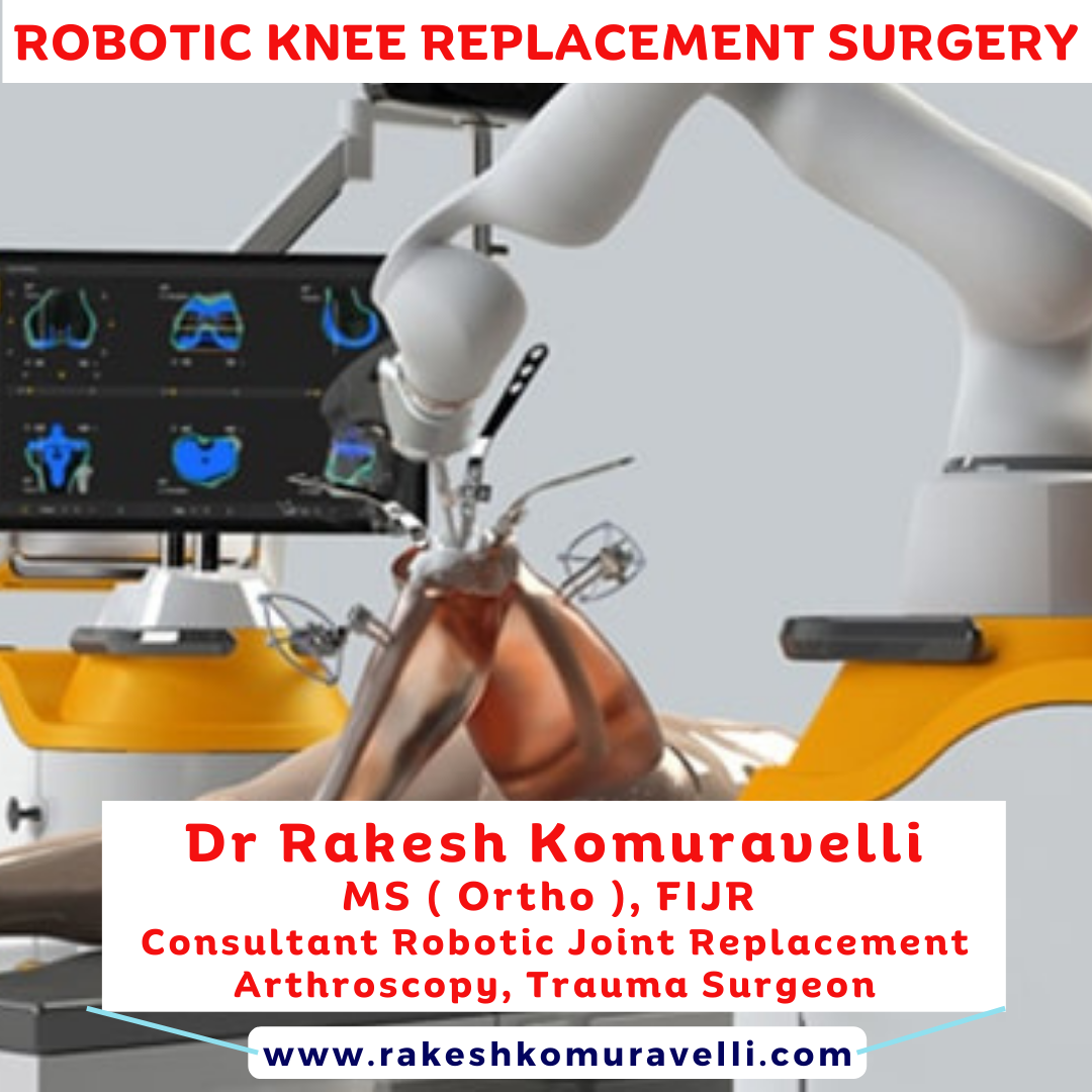 Robotic knee replacement surgery