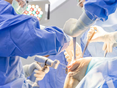 Robotic knee replacement surgery