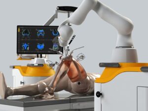 robotic-knee-replacement-surgery