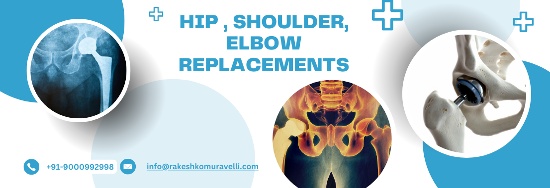 Hip , Shoulder, Elbow Replacements