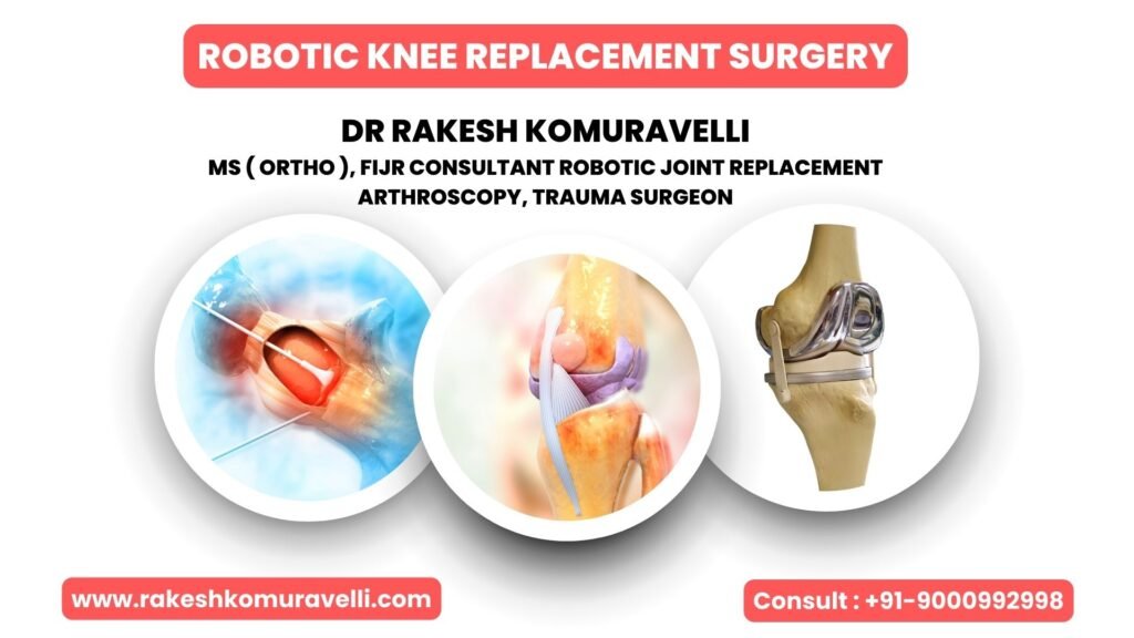 Best Orthopedic Surgeon in RTC Cross Roads | Top Robotic Knee ...